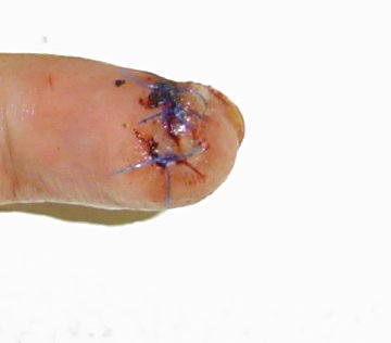 finger1-06-23
