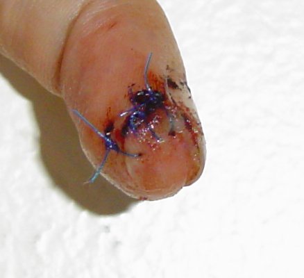 finger1-06-24