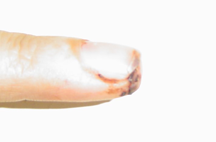 finger1-06-30
