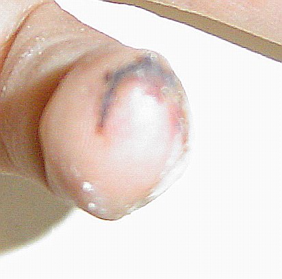 finger1-07-08
