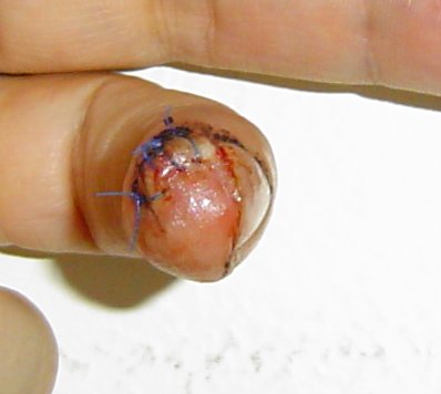 finger2-06-23