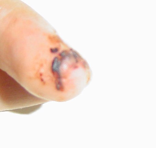 finger2-06-30