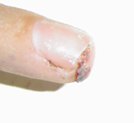 finger2-07-08