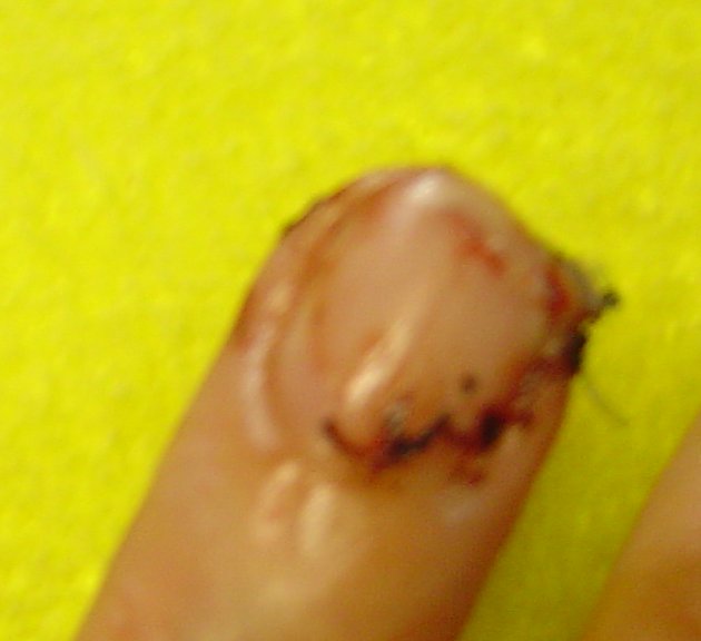 finger2