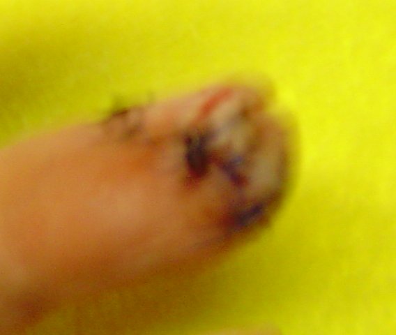 finger3