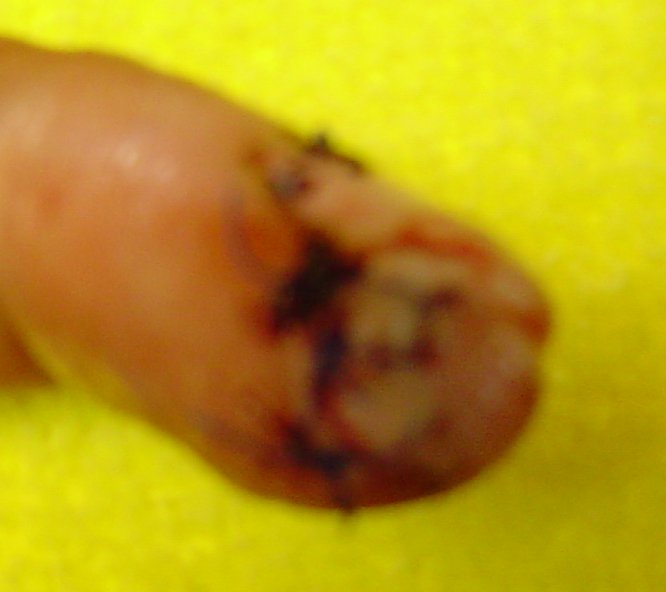 finger4