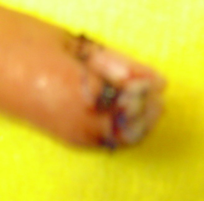 finger5